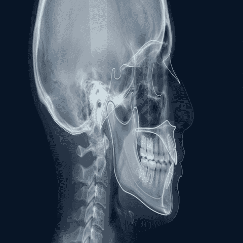 بازگشت نتیجه بعد از جراحی فک (Relapse): چقدر محتمل است و چه چیزی آن را تعیین می‌کند؟